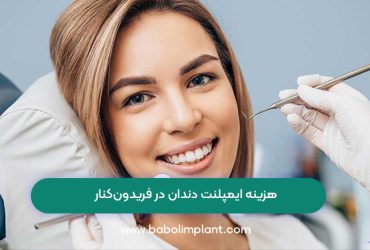 هزینه ایمپلنت دندان در فریدون‌کنار