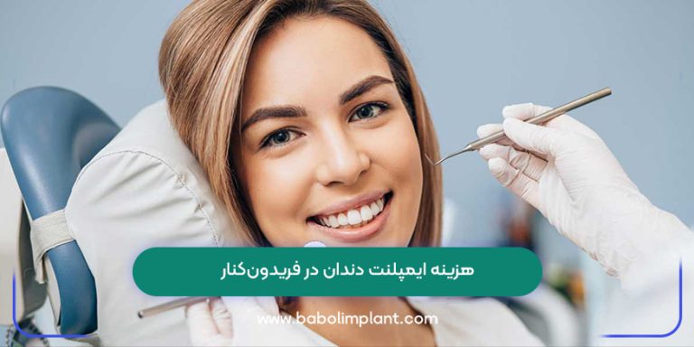 هزینه ایمپلنت دندان در فریدون‌کنار