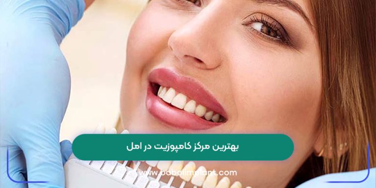 بهترین مرکز کامپوزیت در امل