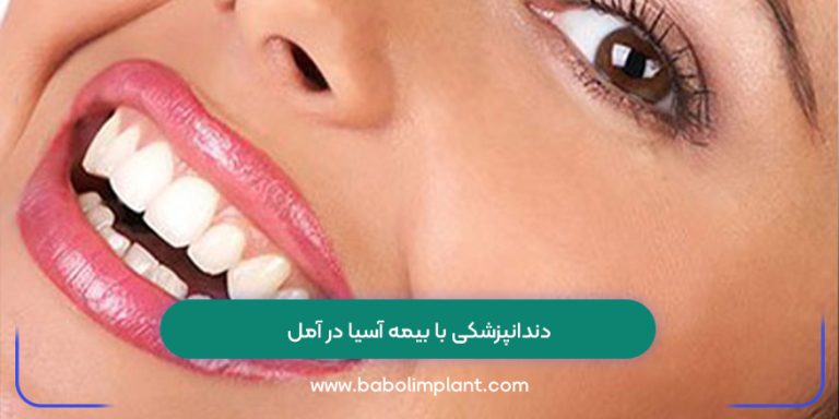 دندانپزشکی با بیمه آسیا در آمل