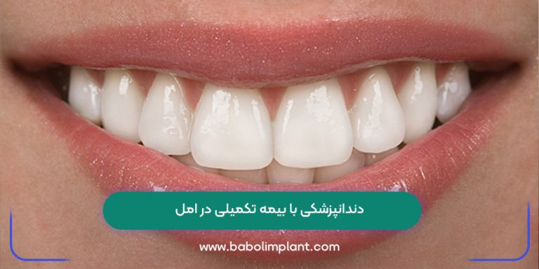 دندانپزشکی با بیمه تکمیلی در امل
