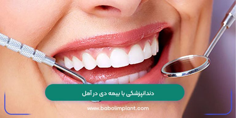 دندانپزشکی با بیمه دی در آمل