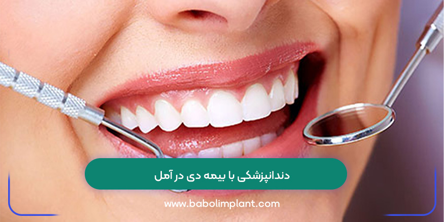 دندانپزشکی با بیمه دی در آمل