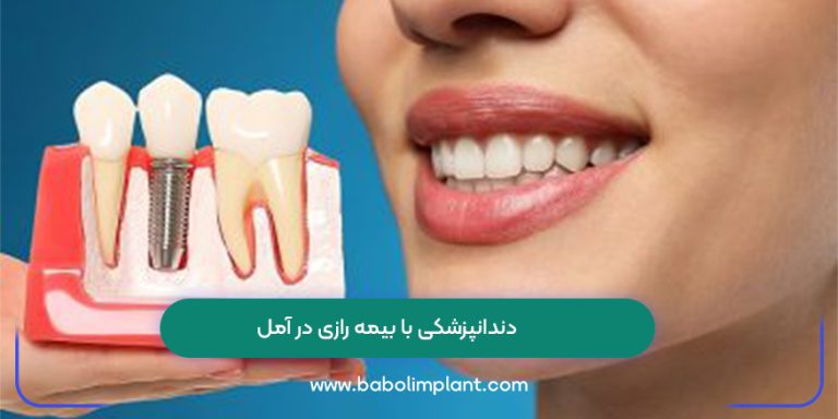 دندانپزشکی با بیمه رازی در آمل