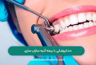 دندانپزشکی با بیمه آتیه ‌سازان ساری