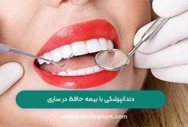 دندانپزشکی با بیمه حافظ در ساری
