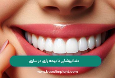 دندانپزشکی با بیمه رازی در ساری