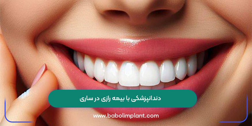 دندانپزشکی با بیمه رازی در ساری