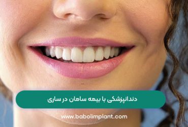 دندانپزشکی با بیمه سامان در ساری