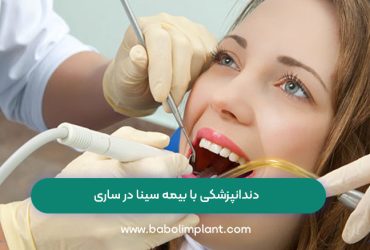دندانپزشکی با بیمه سینا در ساری