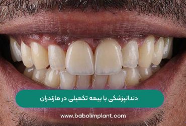 Dentistry with supplementary insurance in Mazandaran