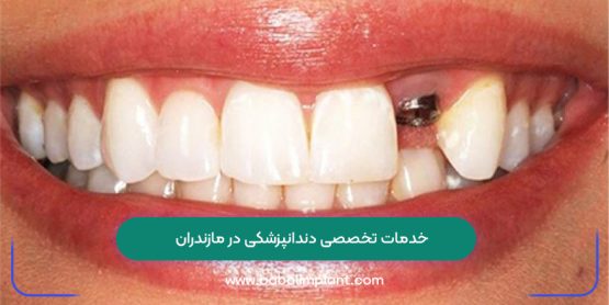 Specialized dental services in Mazandaran