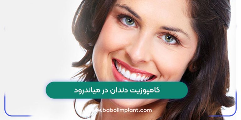 Dental composite in Meanderod