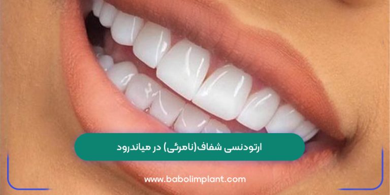 Transparent (invisible) orthodontics in Meanderod