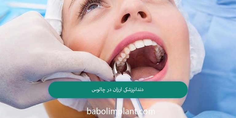 Cheap dentistry in Chalus