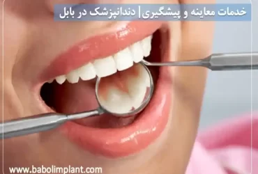 خدمات معاینه و پیشگیری| دندانپزشک در بابل