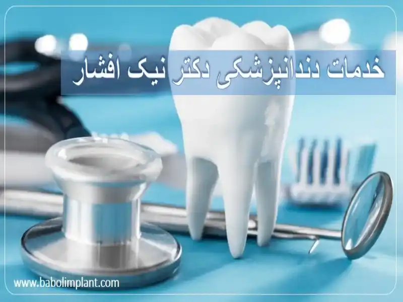 خدمات دندانپزشکی دکتر نیک افشار