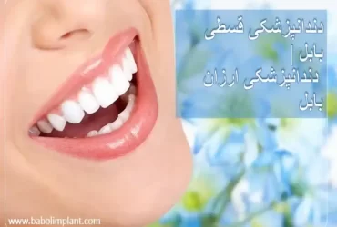 دندانپزشکی قسطی بابل | دندانپزشکی ارزان بابل