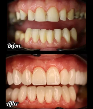 عکسی از نمونه کار دندانپزشکی در بابل