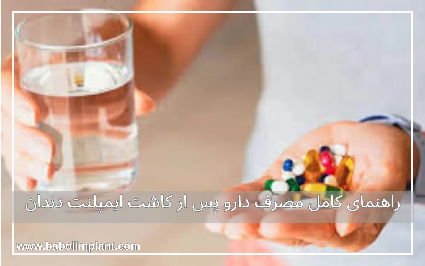 راهنمای کامل مصرف دارو پس از کاشت ایمپلنت دندان