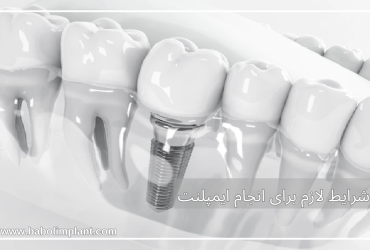 شرایط لازم برای انجام <yoastmark class=