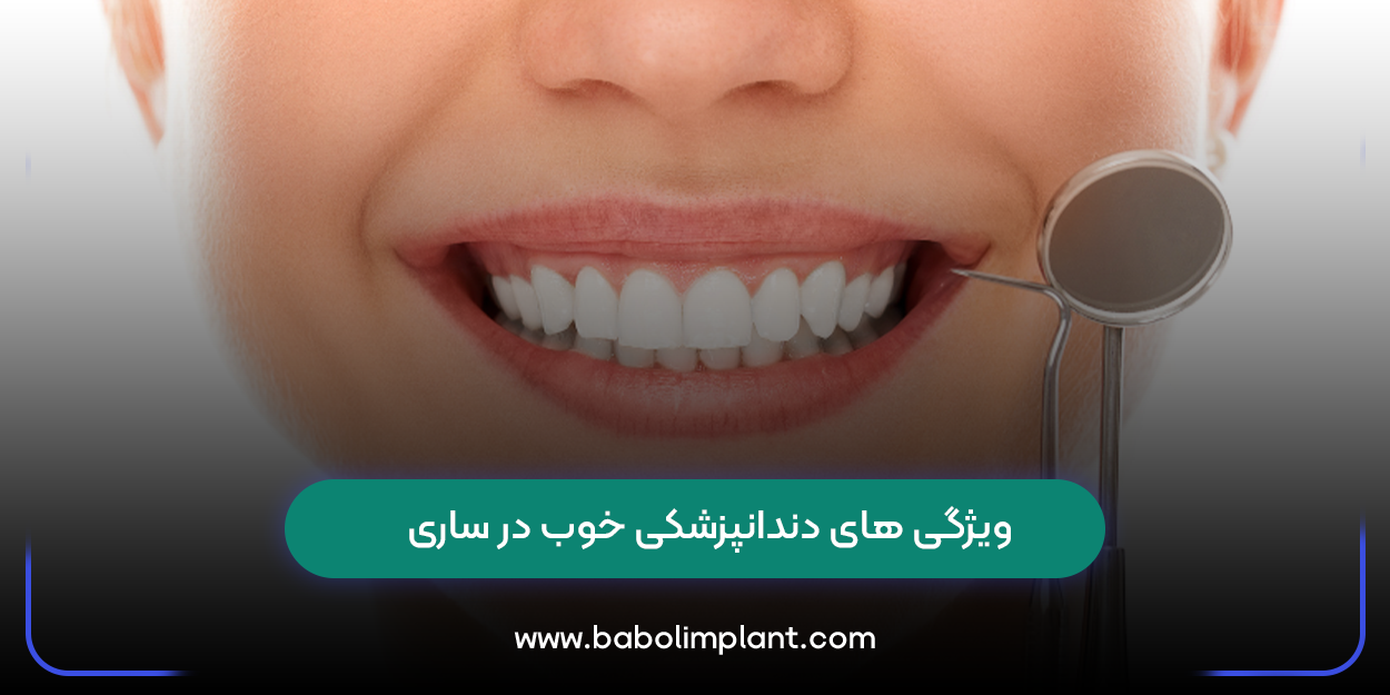 Characteristics of good dentistry in Sari