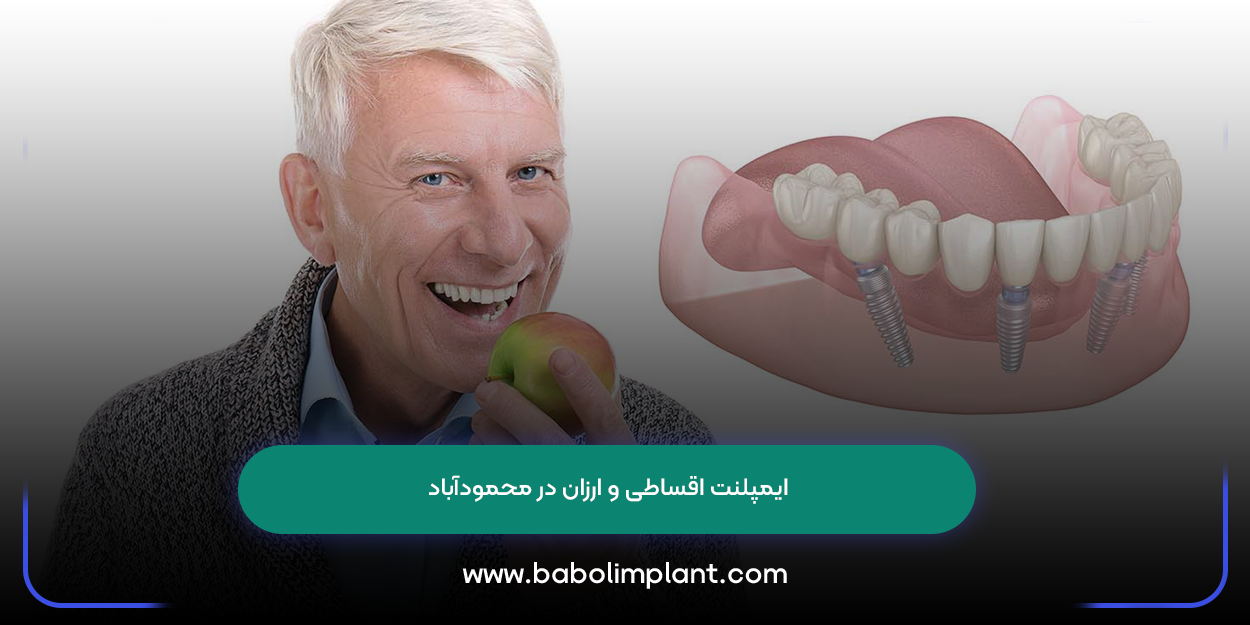 Cheap and installment dental implants in Mahmudabad