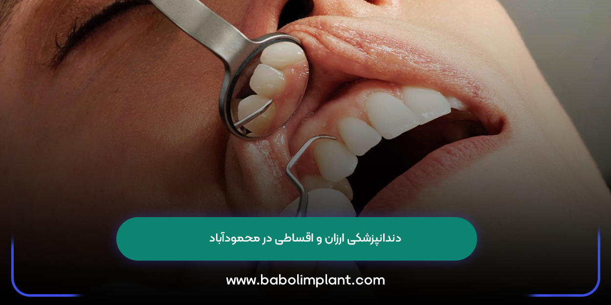 Cheap and installment dentistry in Mahmudabad