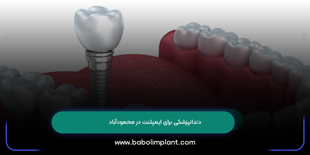 Dentistry for implants in Mahmudabad