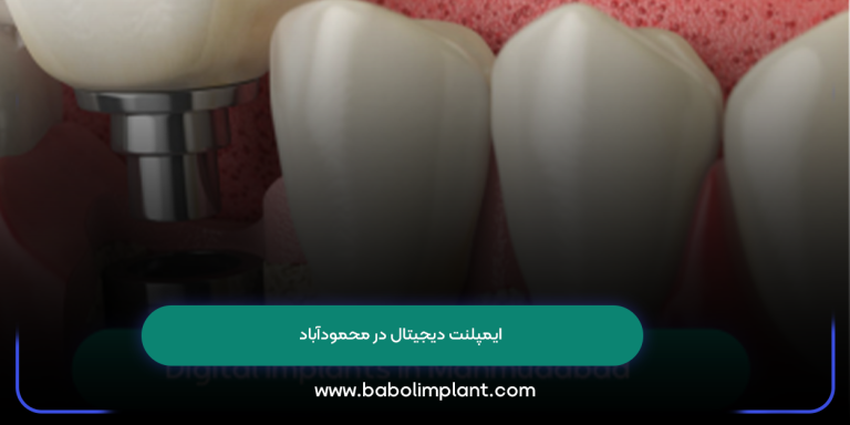 Digital implants in Mahmudabad