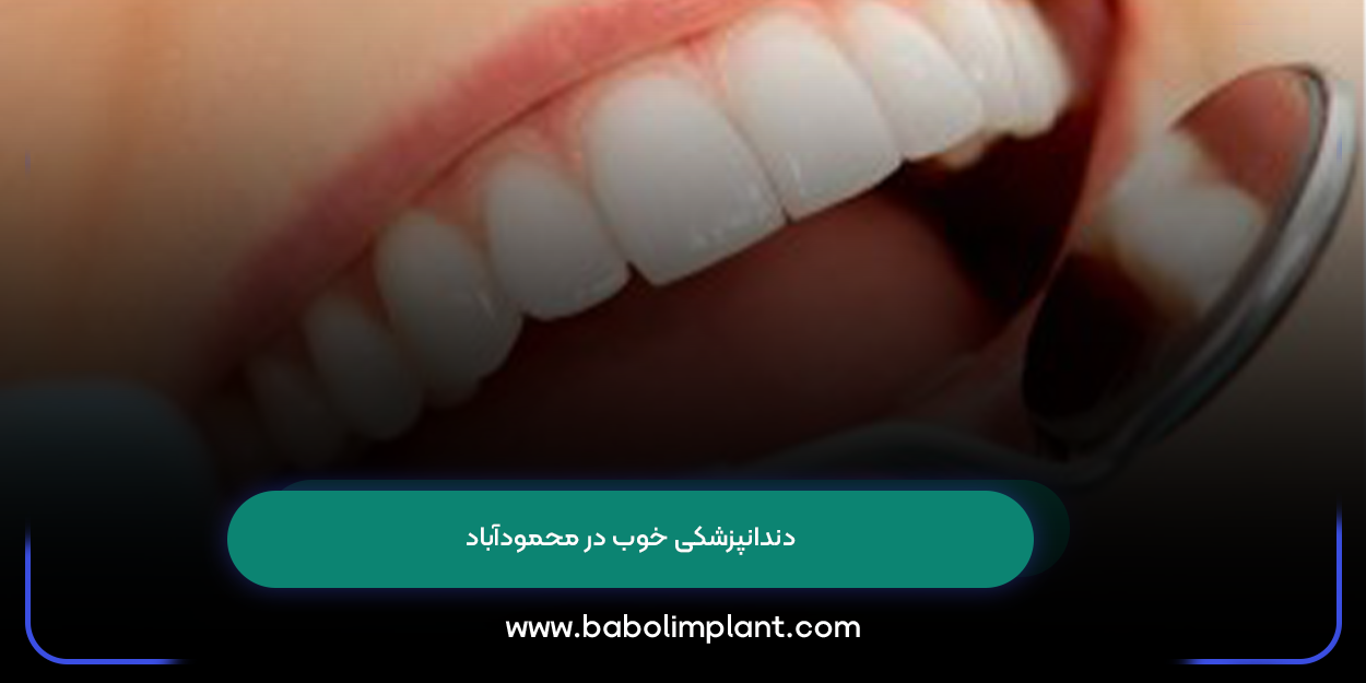 دندانپزشکی خوب در محمودآباد