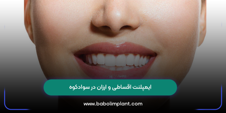 ایمپلنت اقساطی و ارزان در سوادکوه