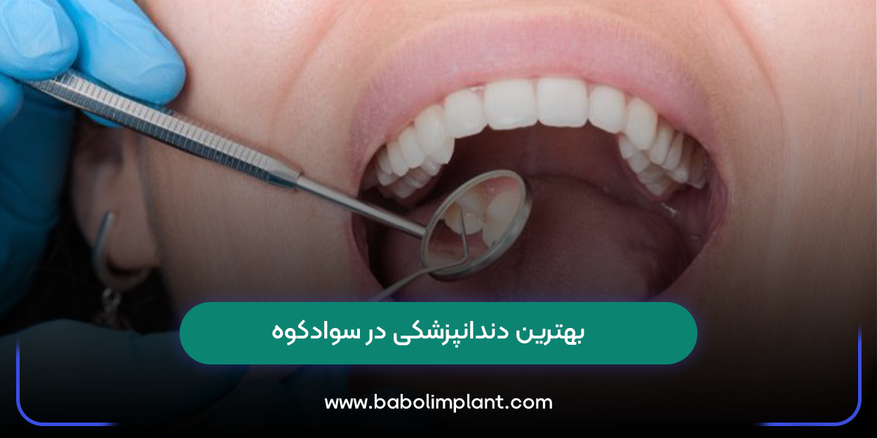 بهترین دندانپزشکی در سوادکوه