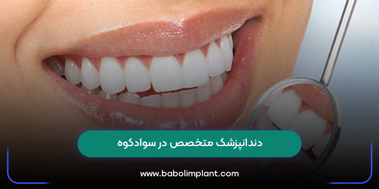 دندانپزشک متخصص در سوادکوه