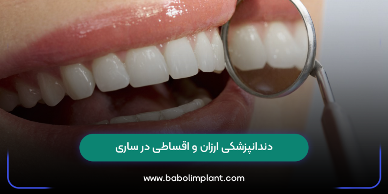 دندانپزشکی ارزان و اقساطی در ساری