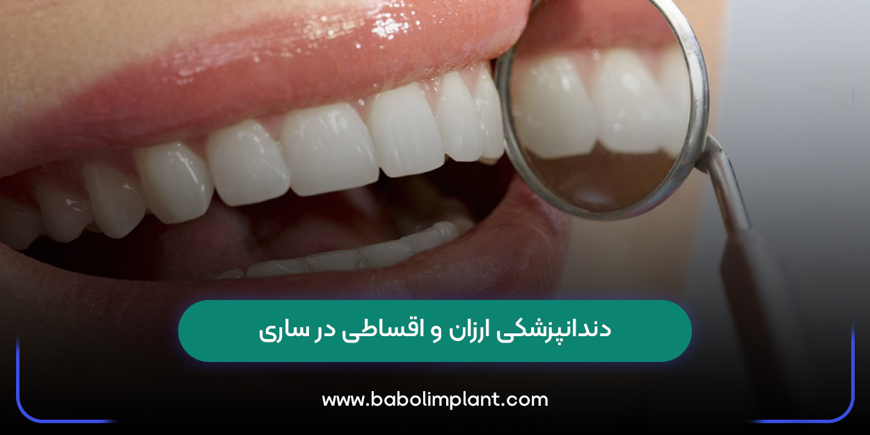 دندانپزشکی ارزان و اقساطی در ساری