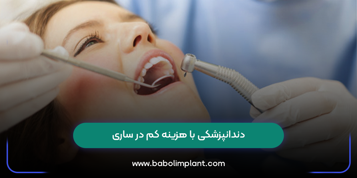 دندانپزشکی با هزینه کم در ساری