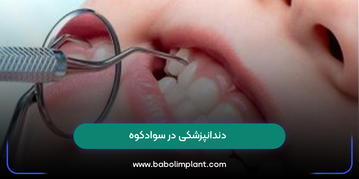 دندانپزشکی در سوادکوه