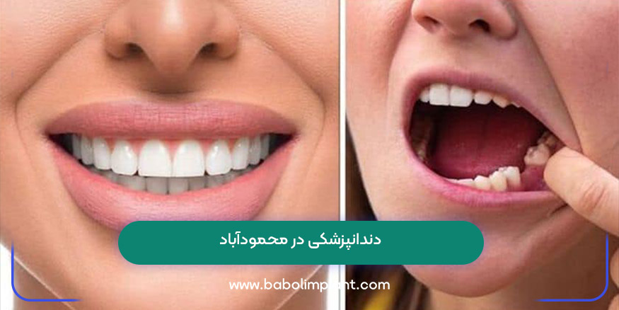 دندانپزشکی در محمودآباد