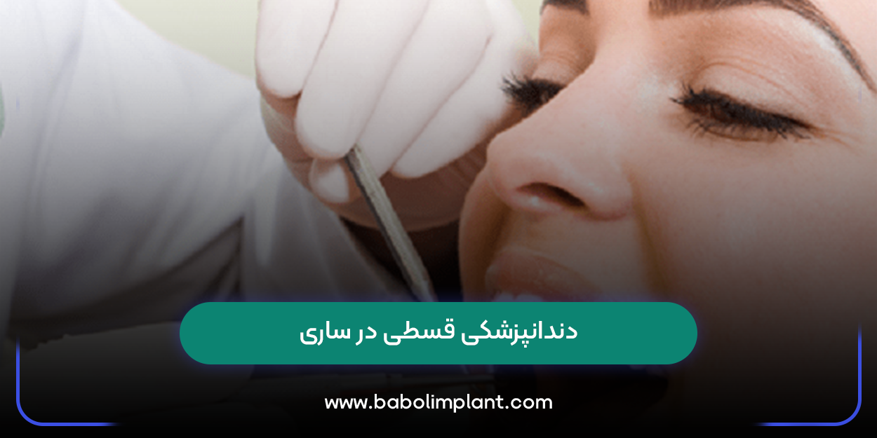 دندانپزشکی قسطی در ساری
