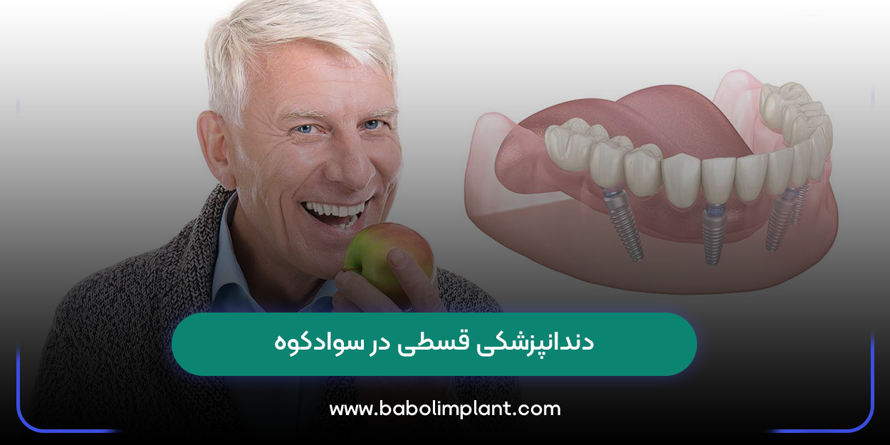 دندانپزشکی قسطی در سوادکوه