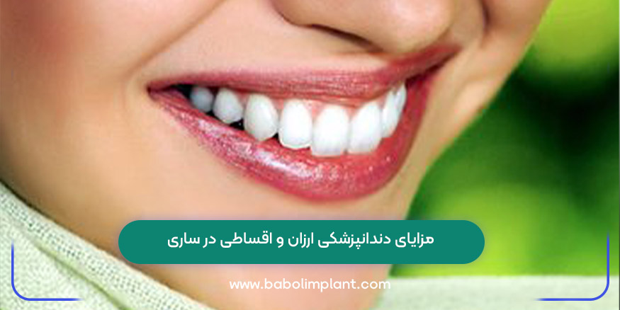 مزایای دندانپزشکی ارزان و اقساطی در ساری