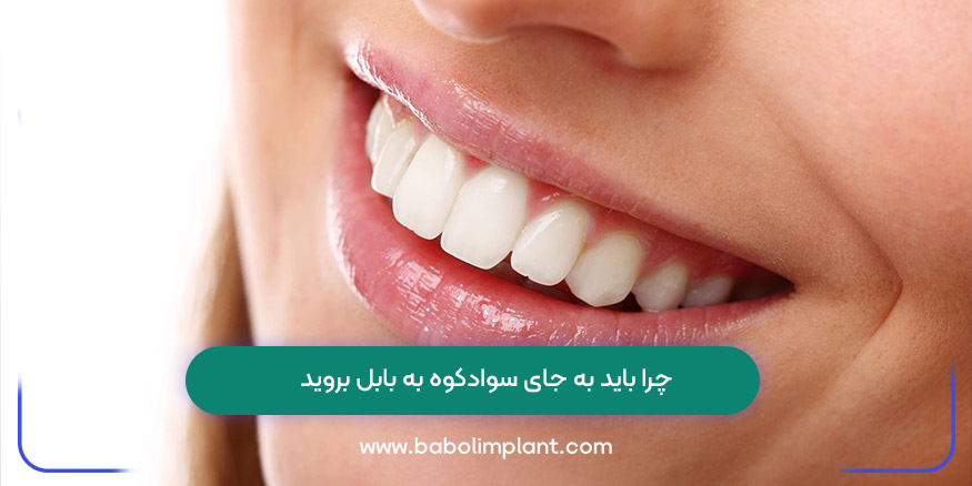 چرا باید به جای سوادکوه به بابل بروید