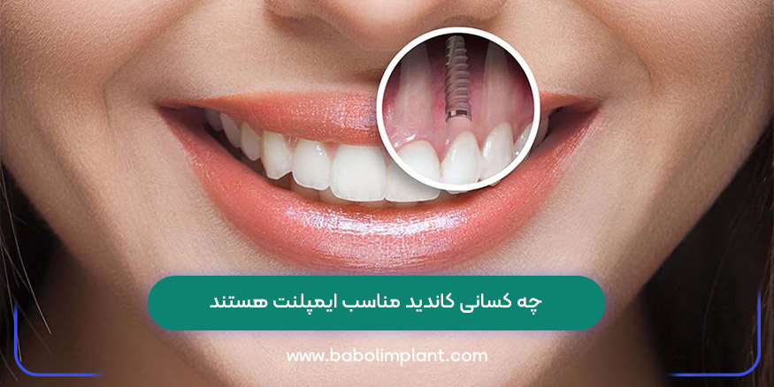 چه کسانی کاندید مناسب ایمپلنت هستند