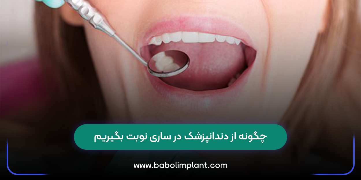 چگونه از دندانپزشک در ساری نوبت بگیریم