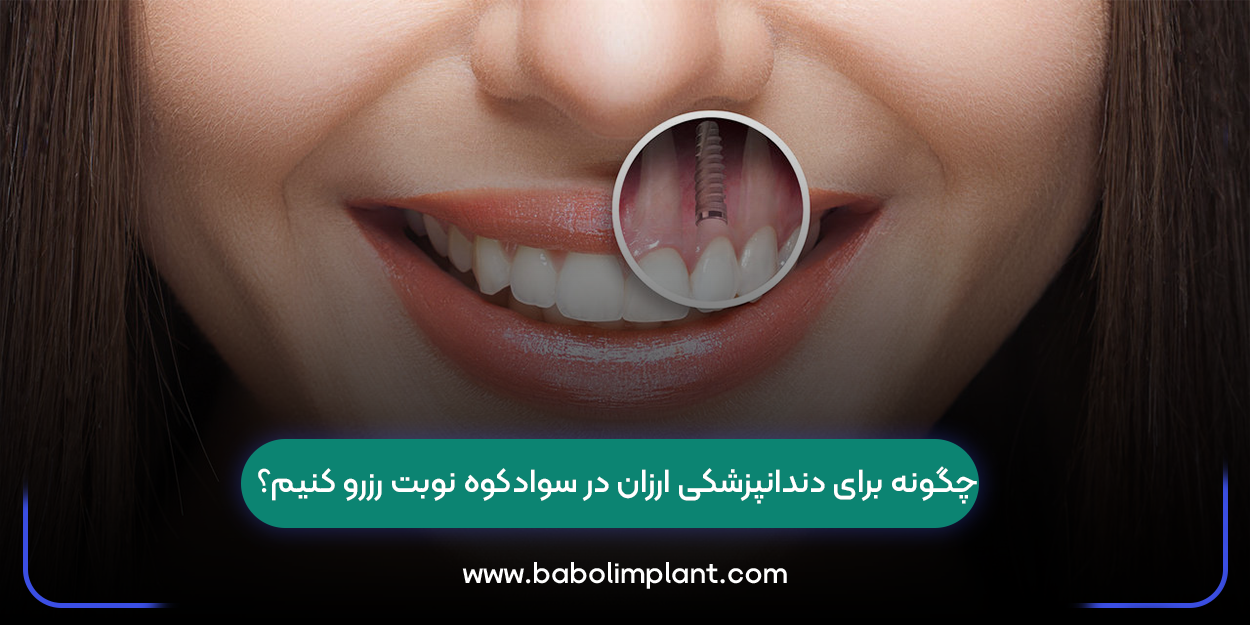 چگونه برای دندانپزشکی ارزان در سوادکوه نوبت رزرو کنیم؟