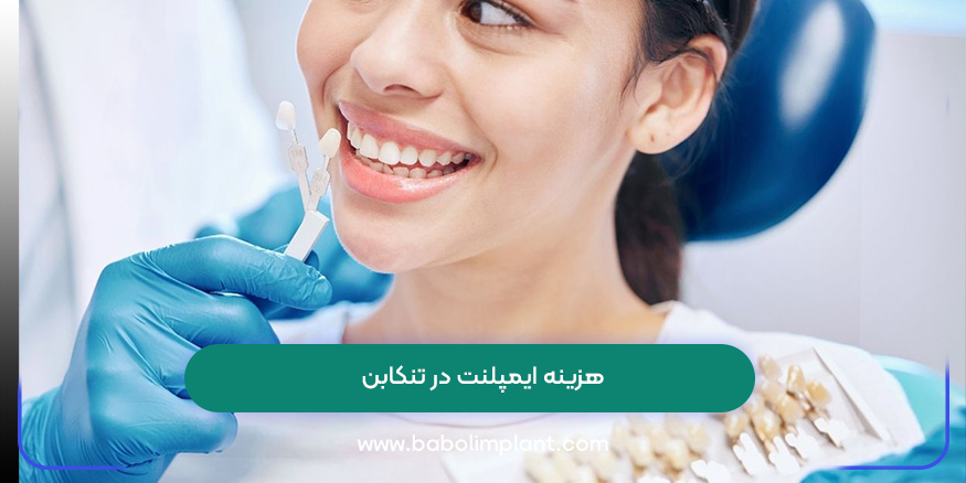 هزینه ایمپلنت در تنکابن