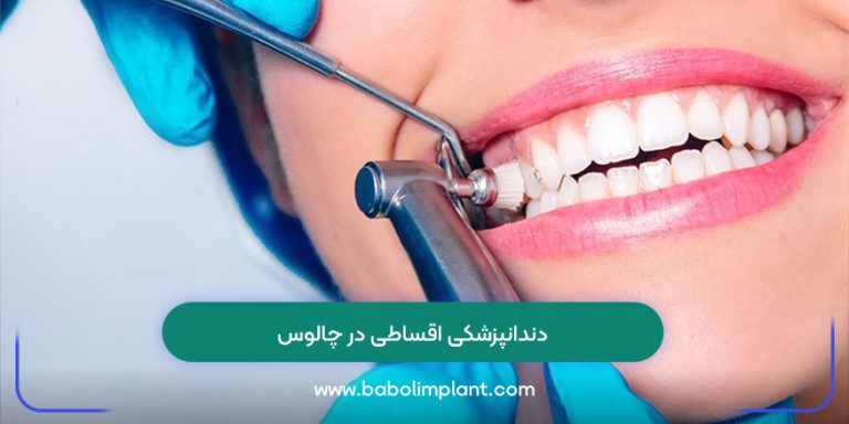 دندانپزشکی اقساطی در چالوس