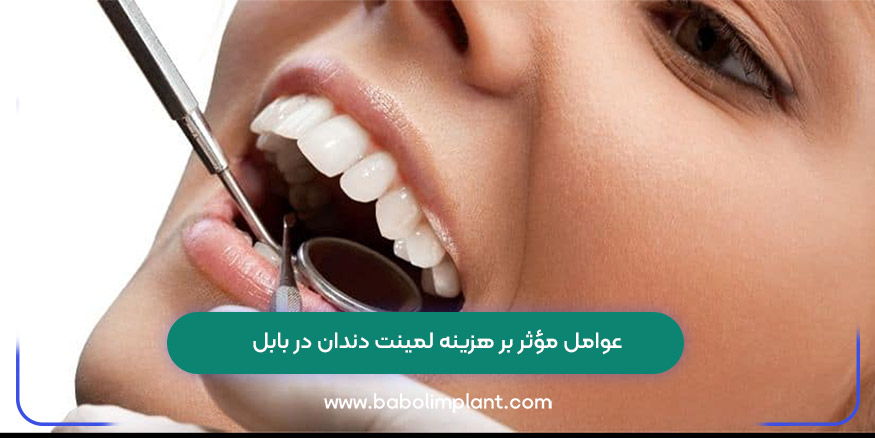 عوامل مؤثر بر هزینه لمینت دندان در بابل