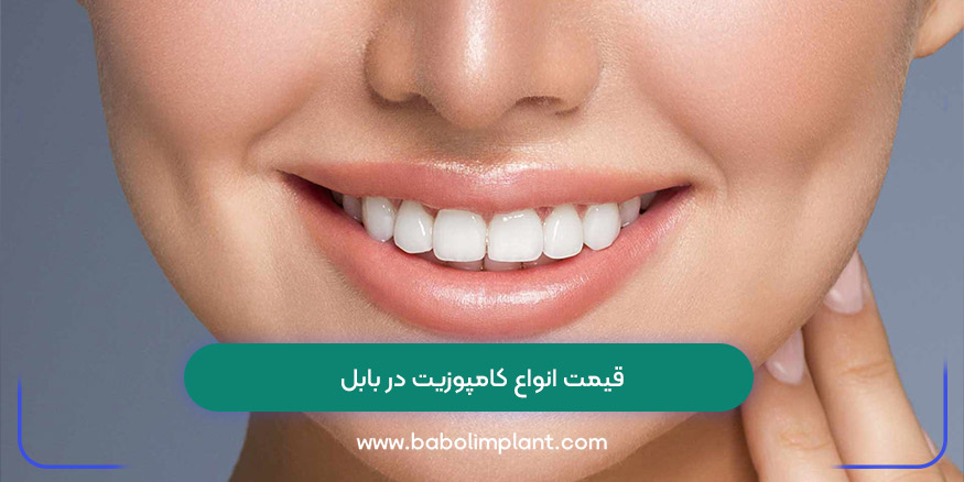 قیمت انواع کامپوزیت در بابل